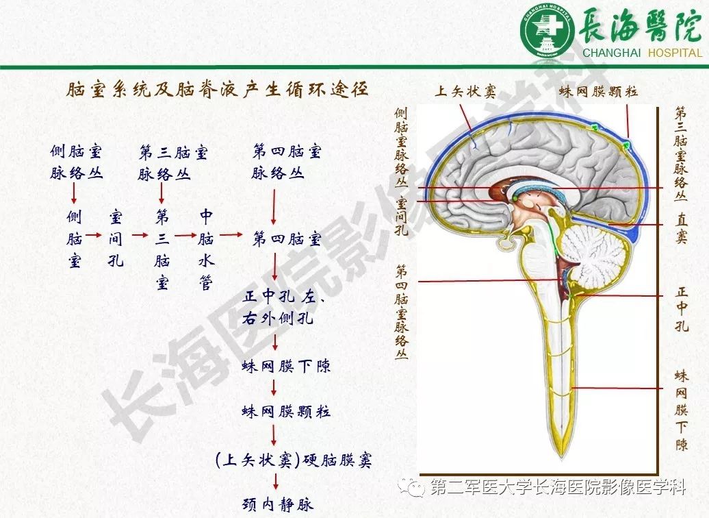 影像PPT - 【PPT】低颅压综合征-6