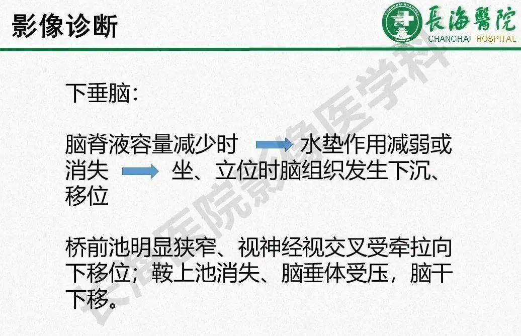 影像PPT - 【PPT】低颅压综合征-24