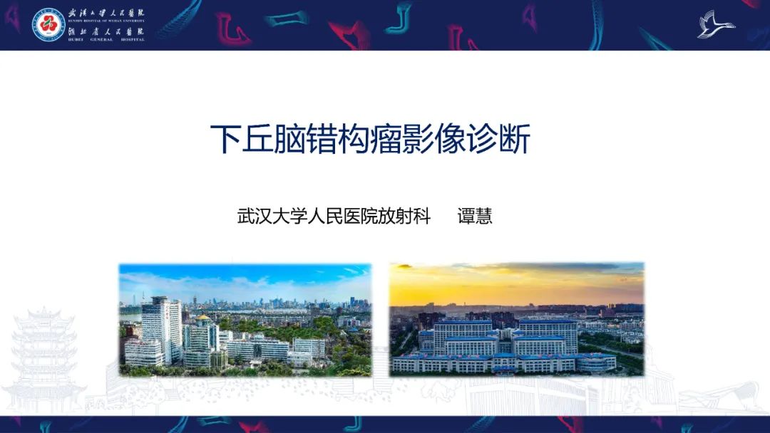 影像PPT - 【PPT】下丘脑错构瘤影像诊断-1
