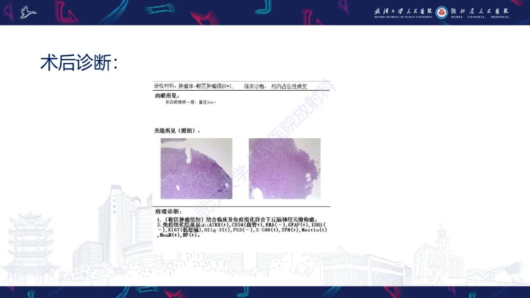 影像PPT - 【PPT】下丘脑错构瘤影像诊断-6