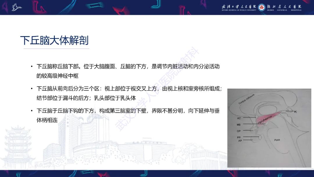 影像PPT - 【PPT】下丘脑错构瘤影像诊断-7
