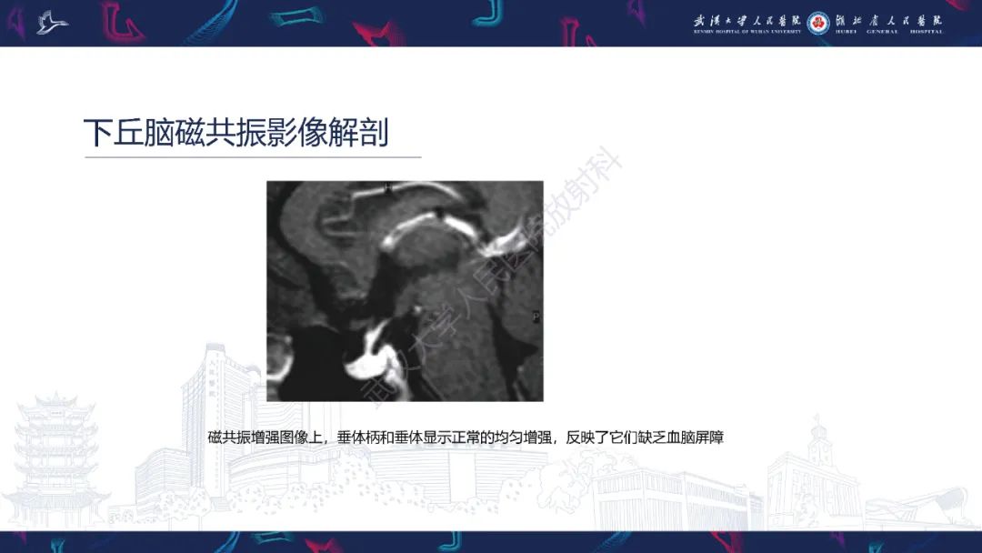 影像PPT - 【PPT】下丘脑错构瘤影像诊断-9