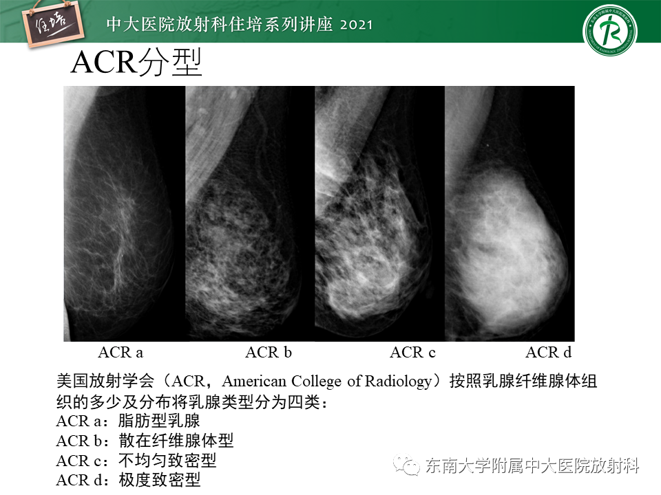 影像PPT - 【PPT】DBT相较于FFDM对于不同X线表现类型乳腺病变的诊断价值-6