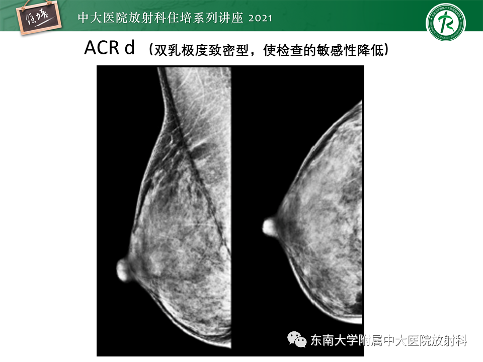 影像PPT - 【PPT】DBT相较于FFDM对于不同X线表现类型乳腺病变的诊断价值-10