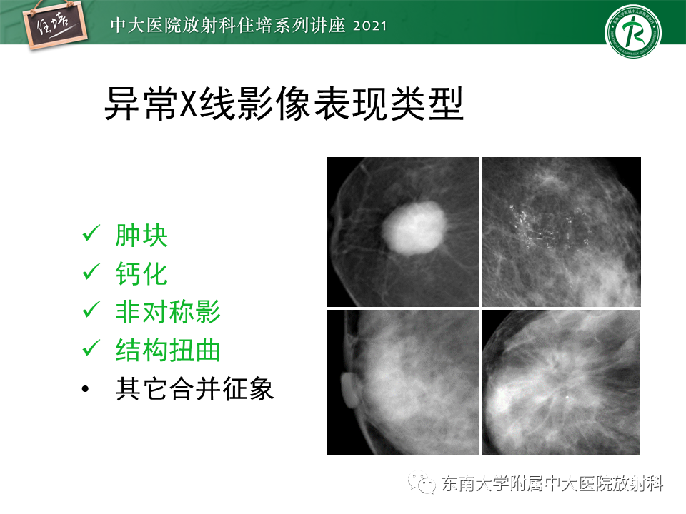 影像PPT - 【PPT】DBT相较于FFDM对于不同X线表现类型乳腺病变的诊断价值-11