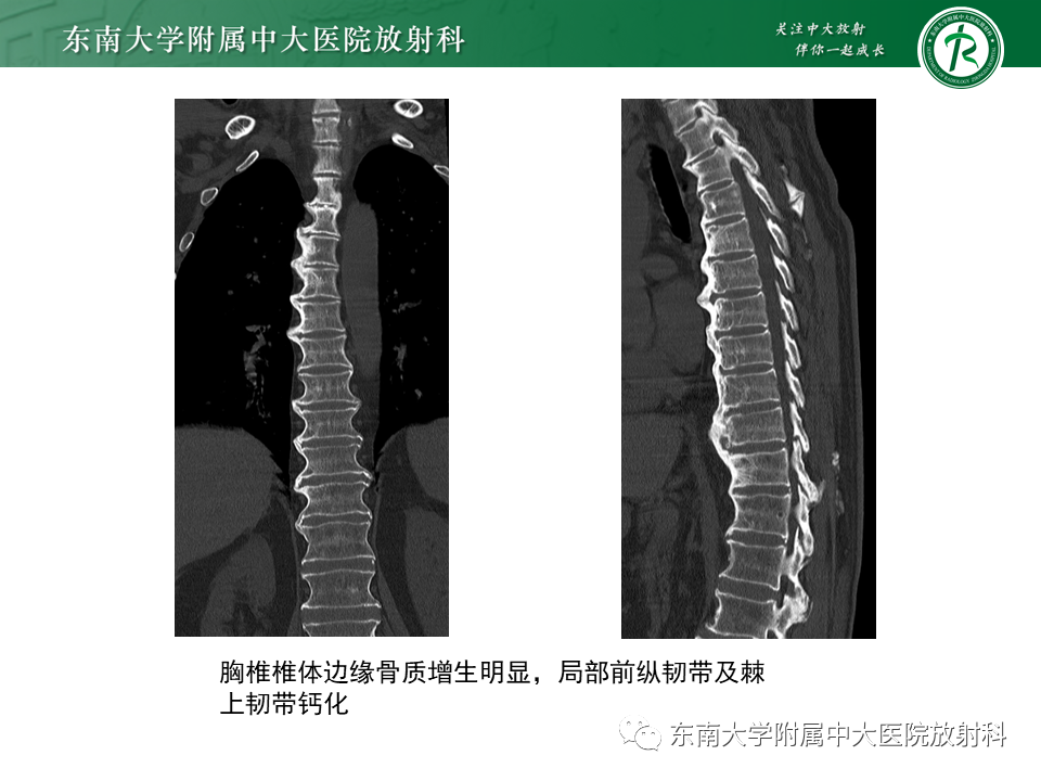影像PPT - -14