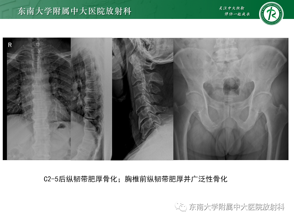 影像PPT - -15
