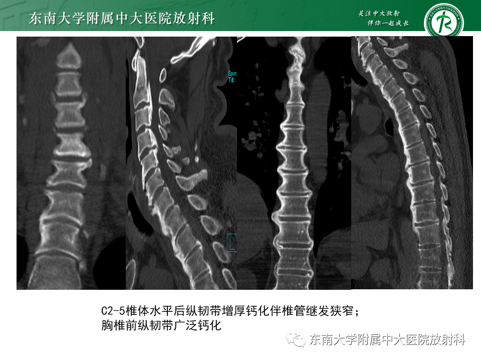 影像PPT - -16