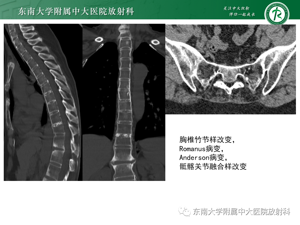 影像PPT - -25