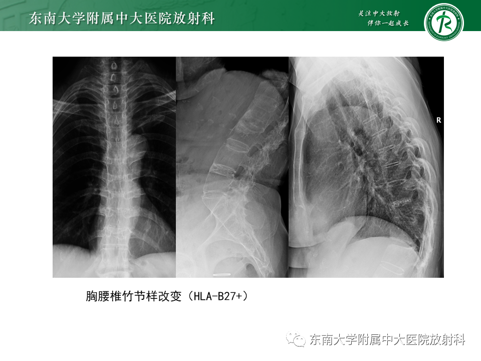 影像PPT - -26