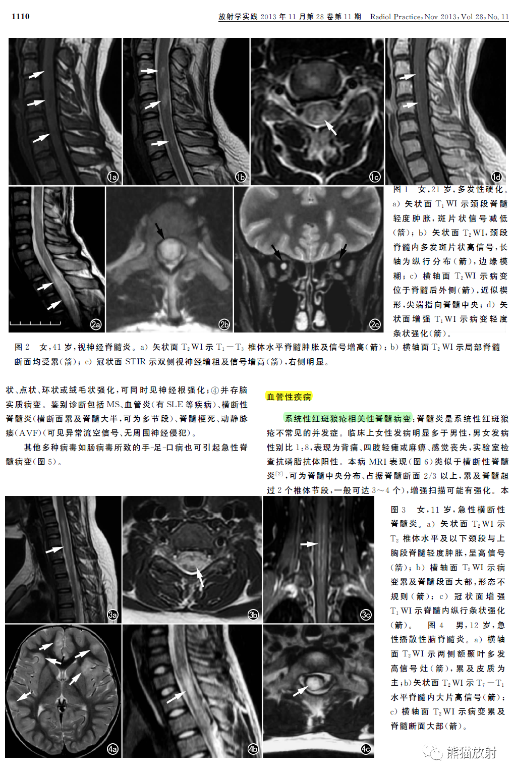 影像PPT - 脊髓急性非肿瘤非外伤性病变的MRI鉴别诊断-2