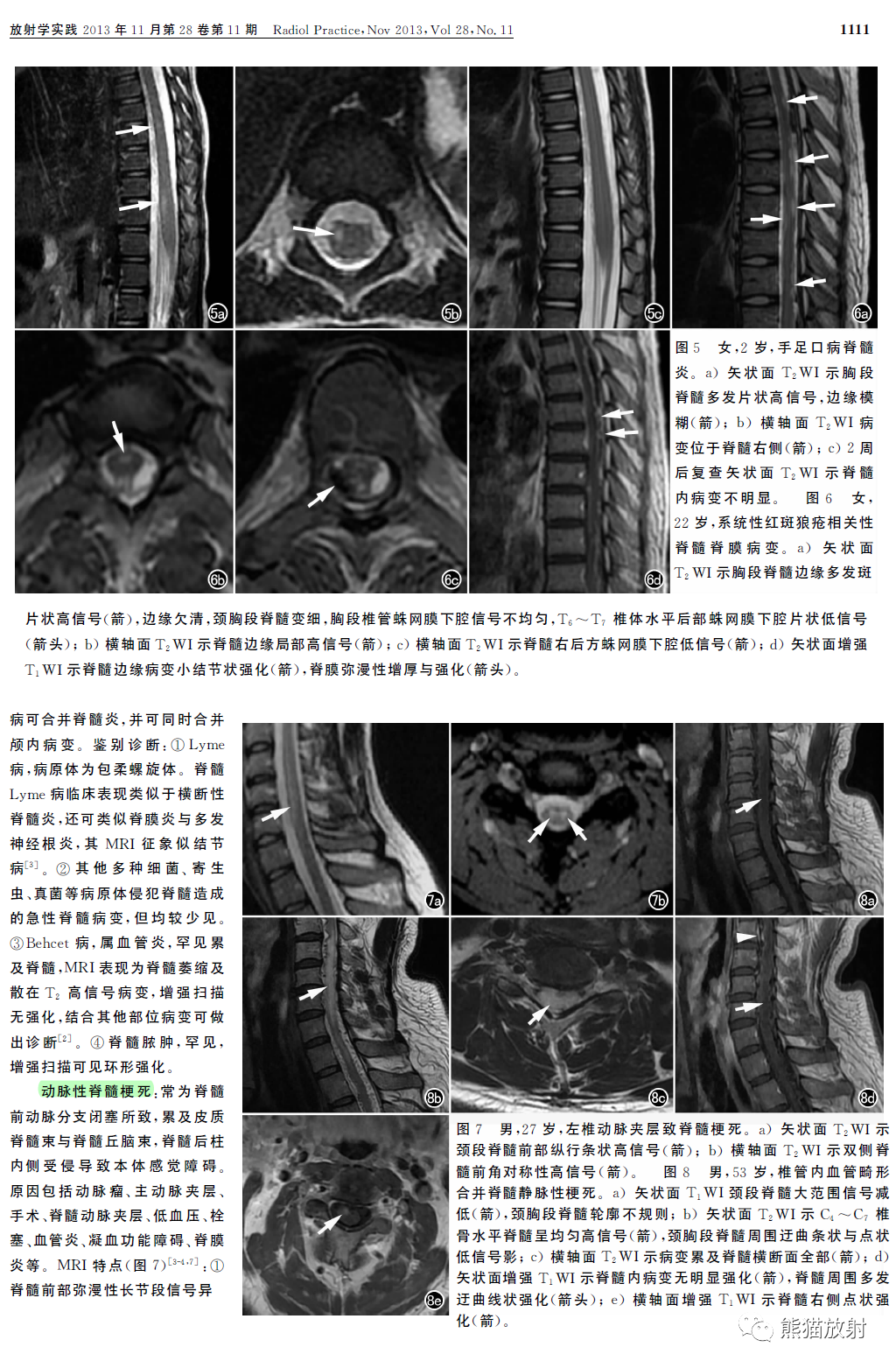 影像PPT - 脊髓急性非肿瘤非外伤性病变的MRI鉴别诊断-3