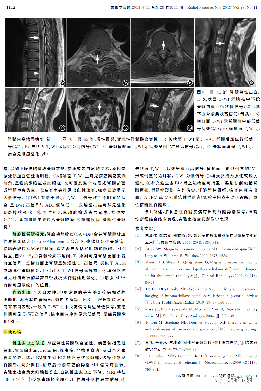 影像PPT - 脊髓急性非肿瘤非外伤性病变的MRI鉴别诊断-4