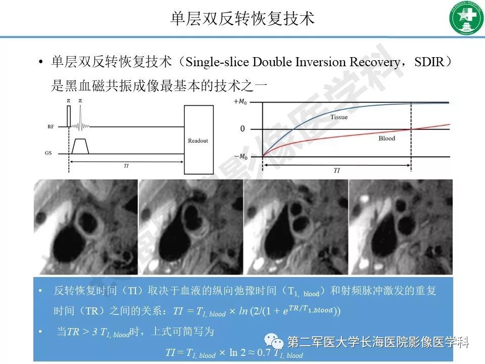 影像PPT - 【PPT】头颈部磁共振血管壁成像技术进展-5
