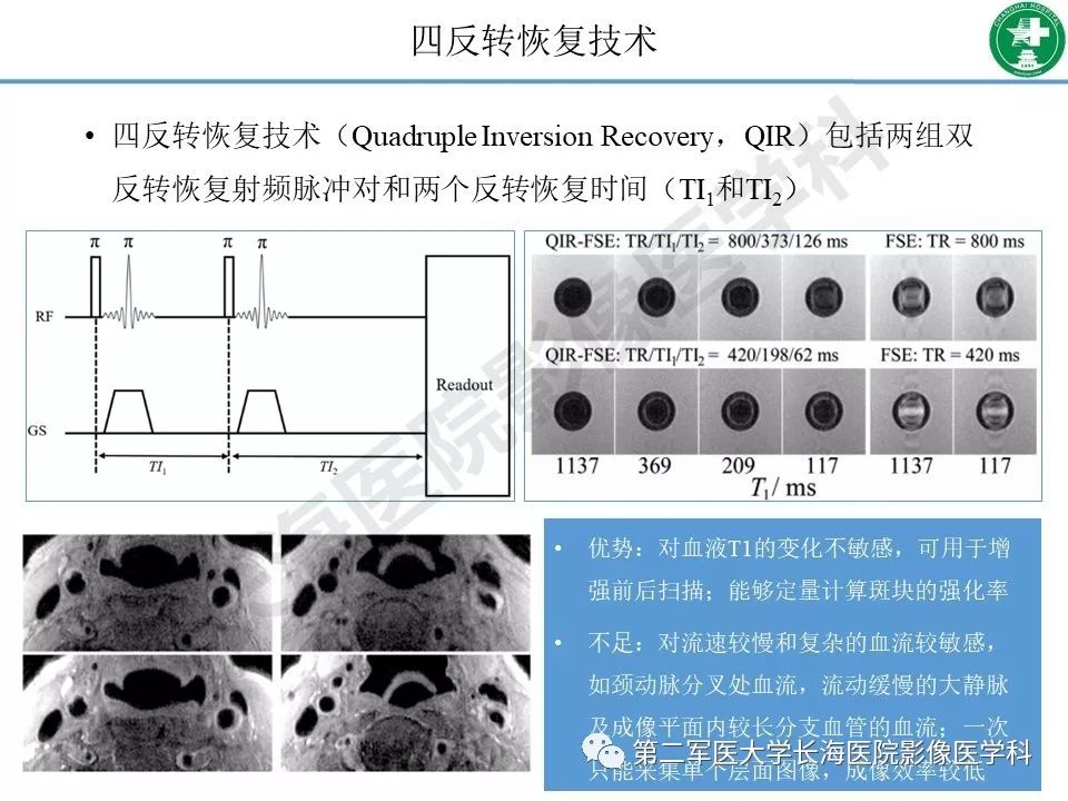 影像PPT - 【PPT】头颈部磁共振血管壁成像技术进展-7