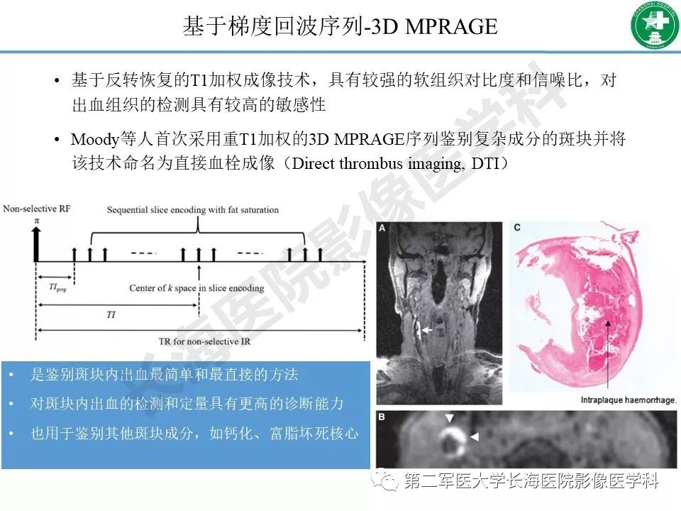 影像PPT - 【PPT】头颈部磁共振血管壁成像技术进展-16