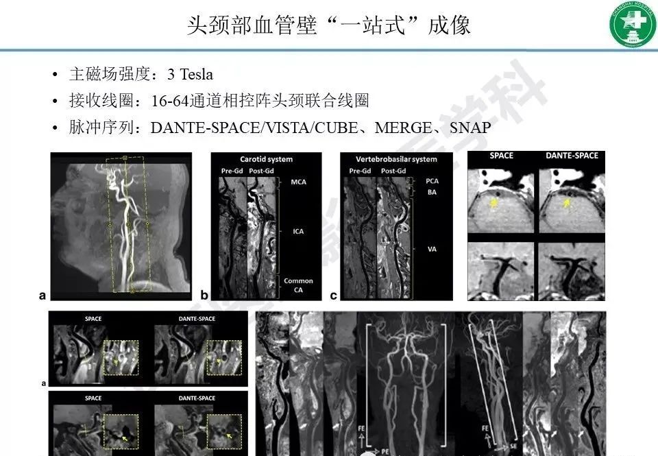 影像PPT - 【PPT】头颈部磁共振血管壁成像技术进展-22