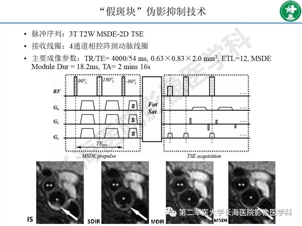 影像PPT - 【PPT】头颈部磁共振血管壁成像技术进展-26
