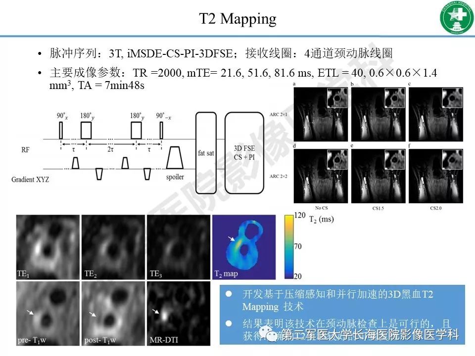 影像PPT - 【PPT】头颈部磁共振血管壁成像技术进展-32
