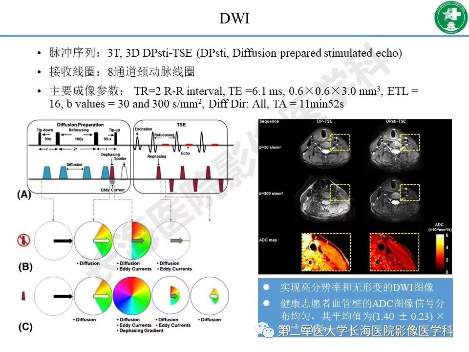 影像PPT - 【PPT】头颈部磁共振血管壁成像技术进展-39