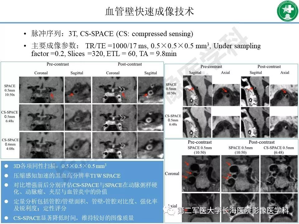 影像PPT - 【PPT】头颈部磁共振血管壁成像技术进展-46