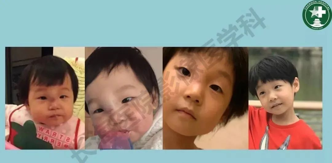 影像PPT - 【PPT】婴幼儿血管瘤与静脉畸形-18