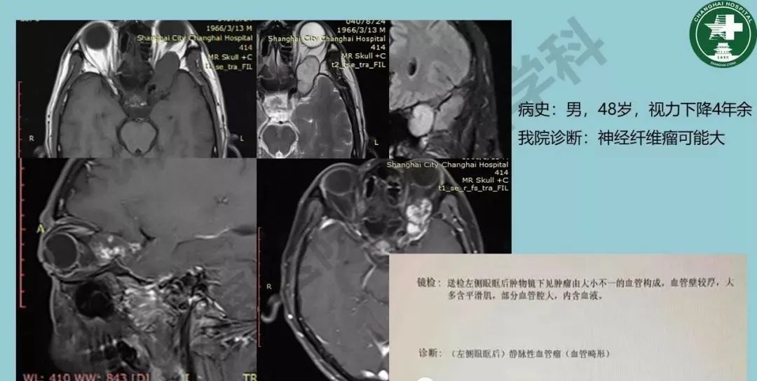 影像PPT - 【PPT】婴幼儿血管瘤与静脉畸形-36