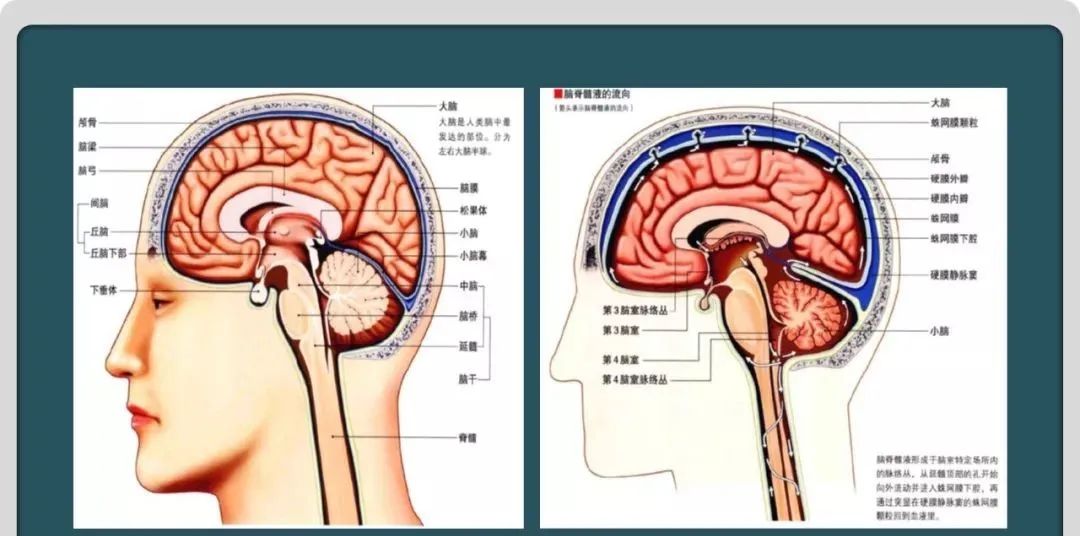 影像PPT - 【PPT】颅内囊性病变的影像学表现-9
