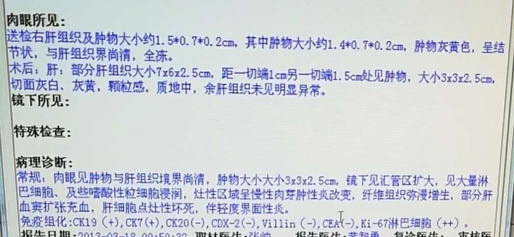 影像PPT - 【病例】肝脏肉芽肿性炎1例CT及MR影像-4
