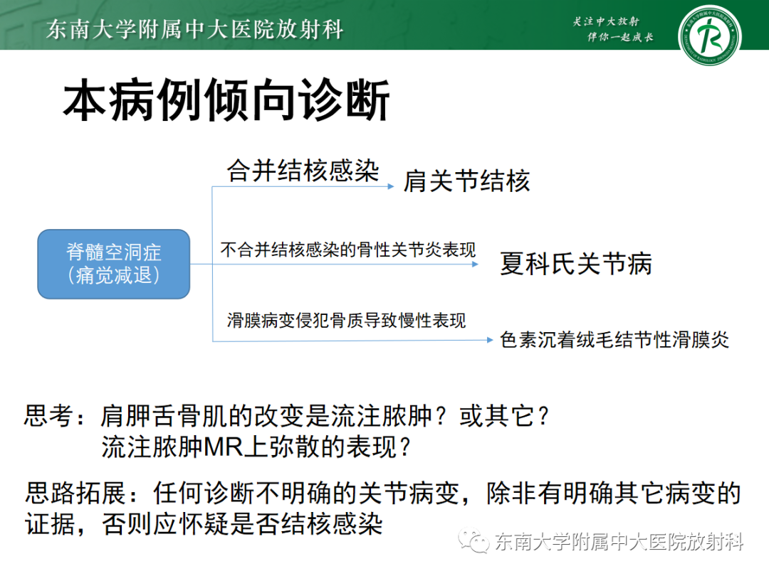 影像PPT - 【病例】慢性肩关节炎1例CT及MR影像-19
