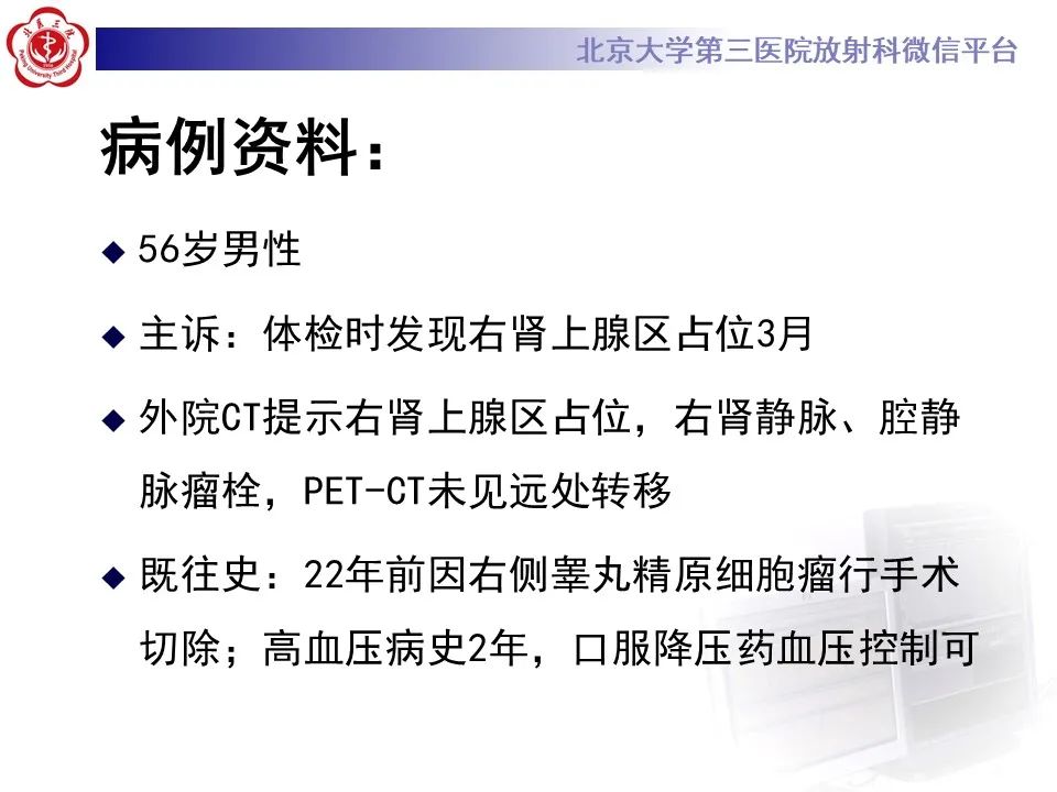 影像PPT - 【PPT】腹膜后平滑肌肉瘤的影像-2