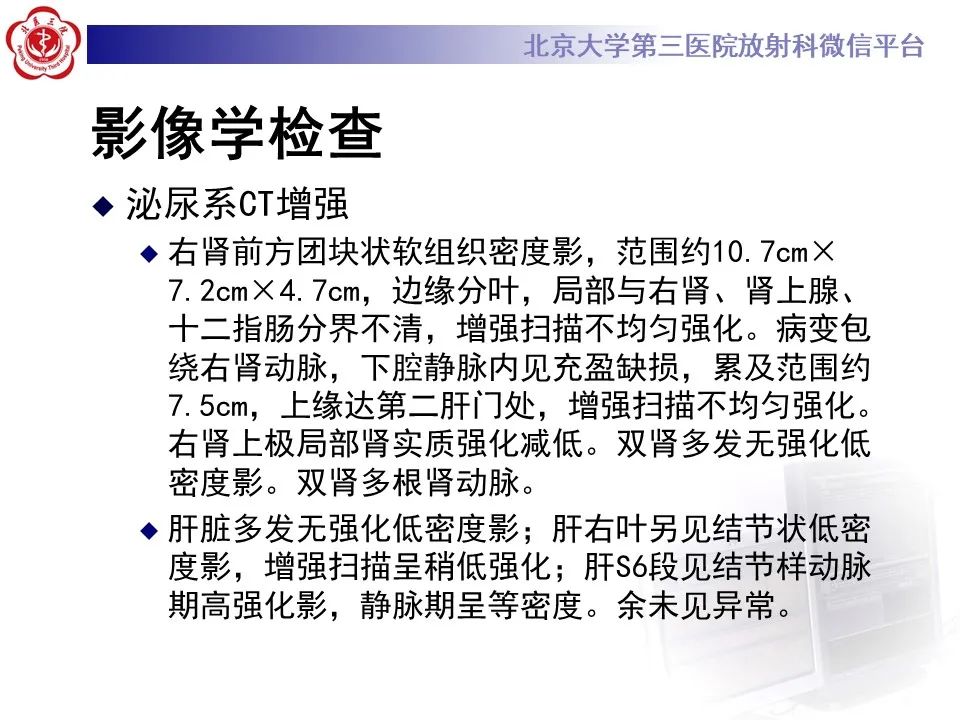 影像PPT - 【PPT】腹膜后平滑肌肉瘤的影像-6