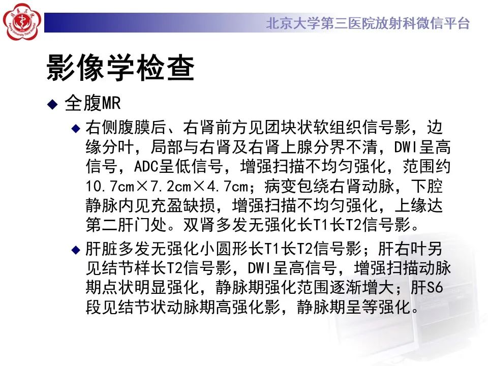 影像PPT - 【PPT】腹膜后平滑肌肉瘤的影像-10