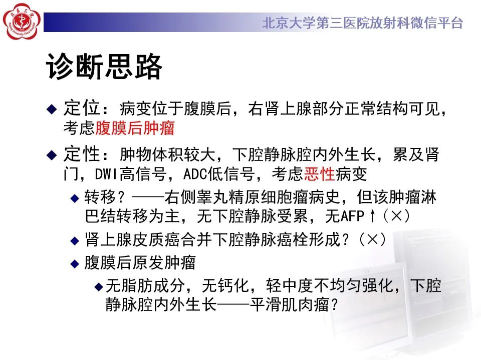 影像PPT - 【PPT】腹膜后平滑肌肉瘤的影像-11