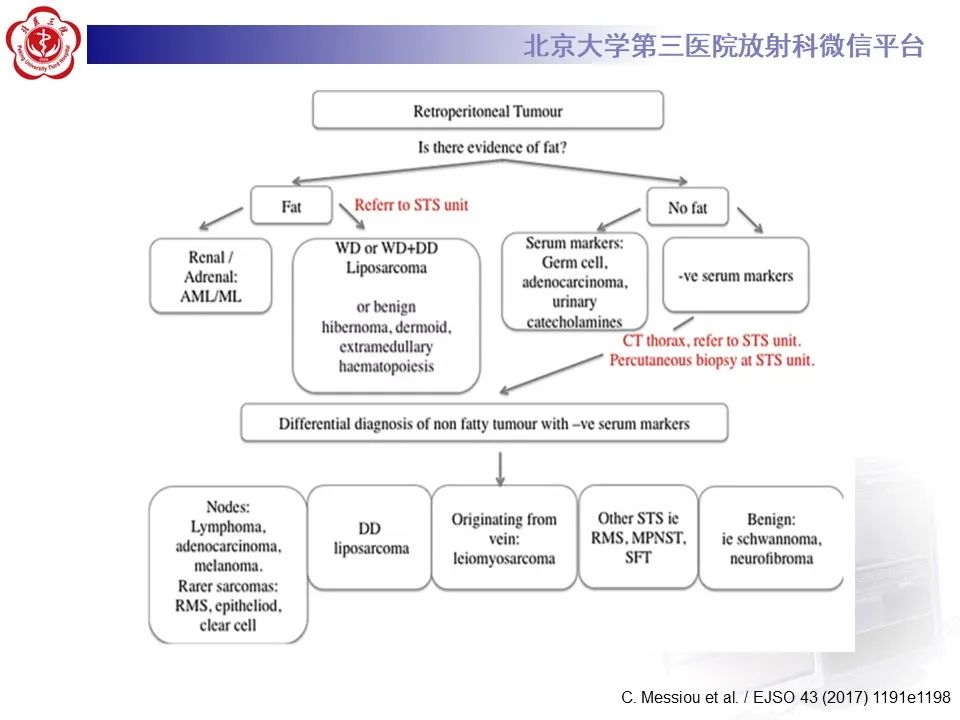影像PPT - 【PPT】腹膜后平滑肌肉瘤的影像-12
