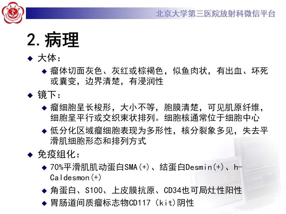 影像PPT - 【PPT】腹膜后平滑肌肉瘤的影像-18