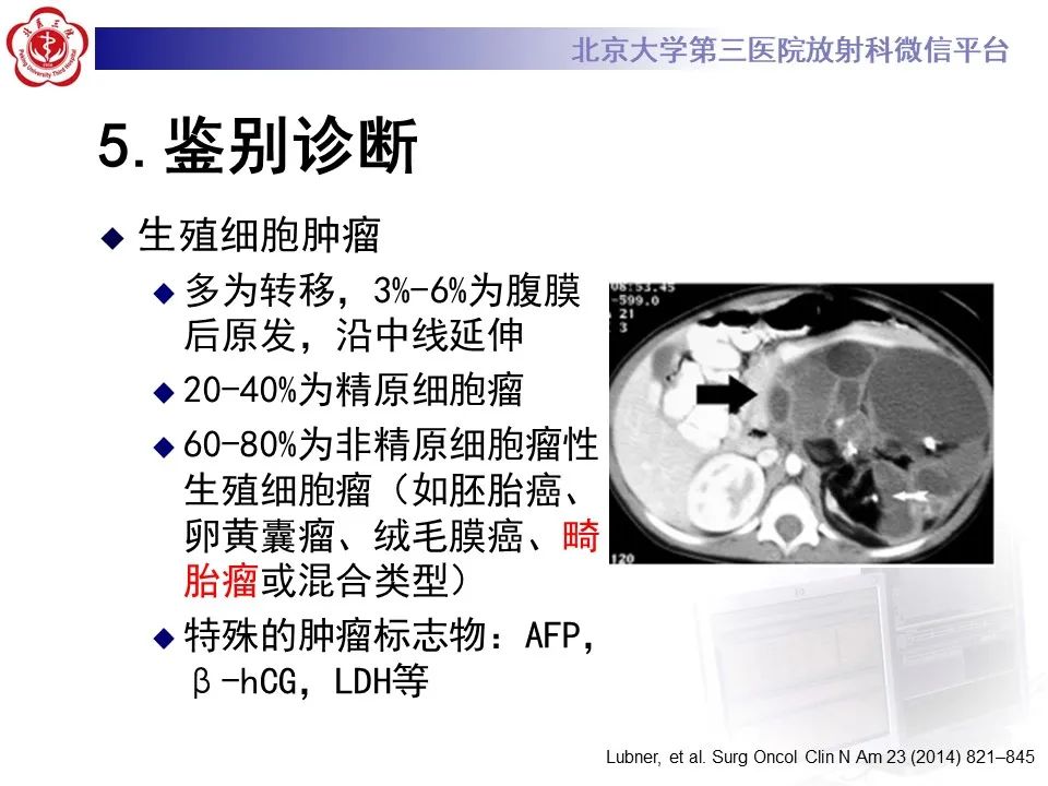 影像PPT - 【PPT】腹膜后平滑肌肉瘤的影像-38