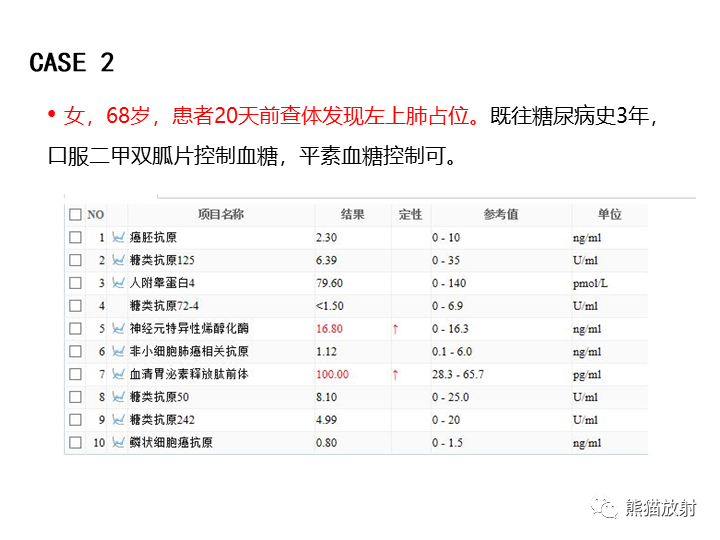 影像PPT - 【病例】支气管扩张并感染VS微浸润性腺癌-11