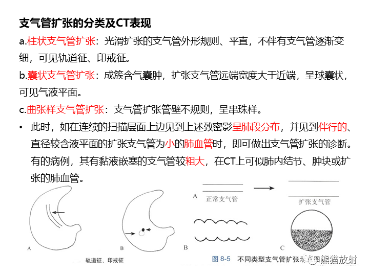 影像PPT - 【病例】支气管扩张并感染VS微浸润性腺癌-29