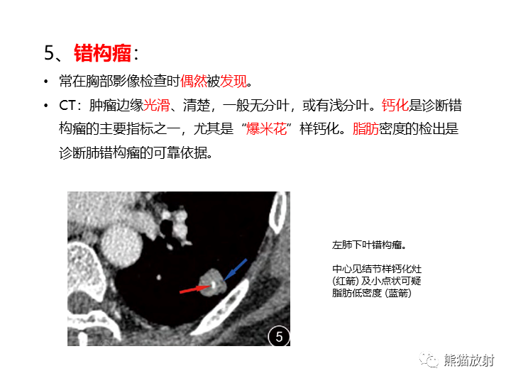 影像PPT - 【病例】支气管扩张并感染VS微浸润性腺癌-34