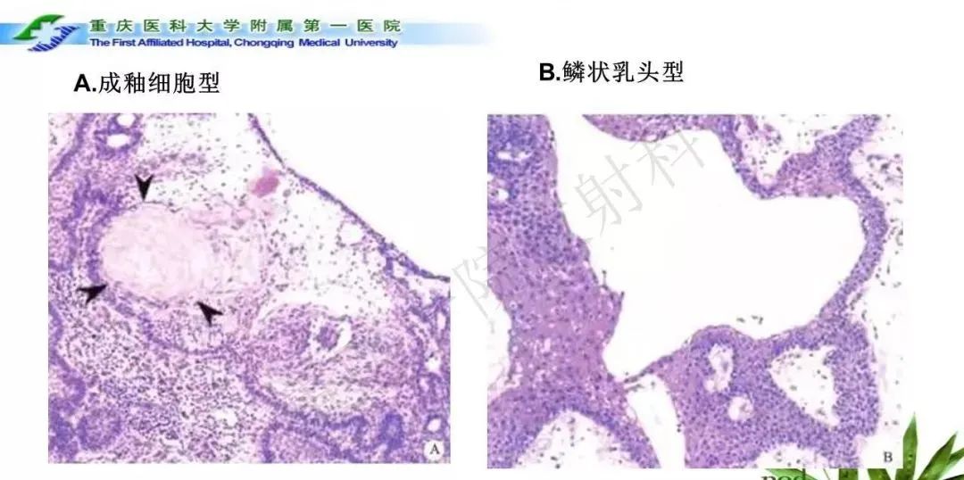 影像PPT - 【PPT】鞍下颅咽管瘤的诊断与鉴别诊断-7