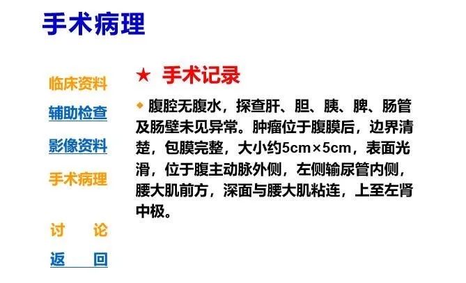 影像PPT - 【病例】腹膜后上皮样血管内皮瘤1例CT-3