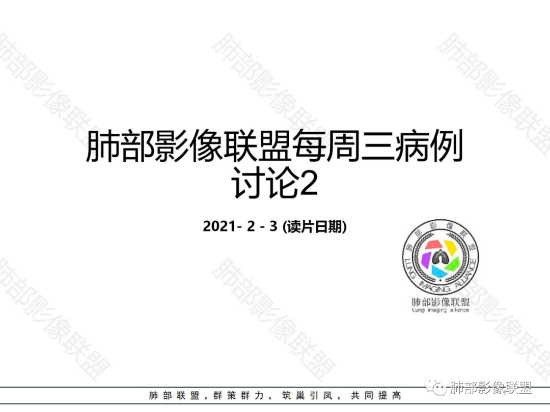 影像PPT - 【病例】左下肺典型类癌1例CT影像讨论-1 影像PPT - 【病例】左下肺典型类癌1例CT影像讨论-1