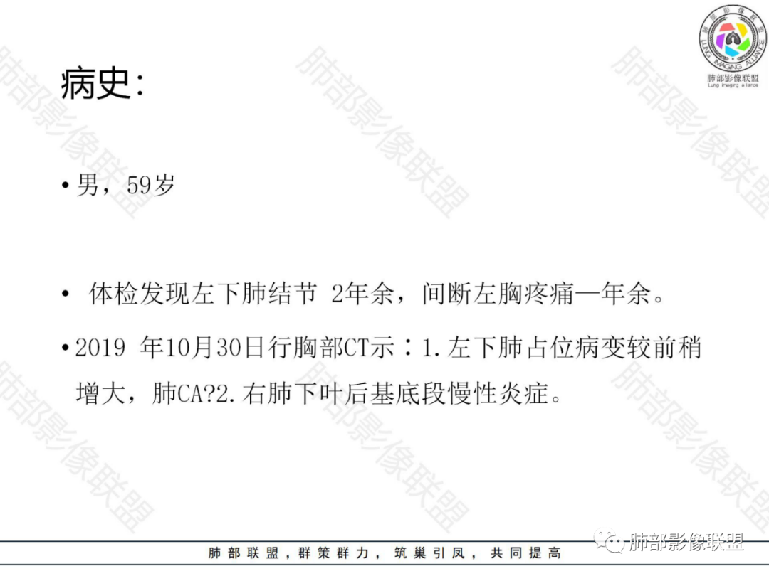 影像PPT - 【病例】左下肺典型类癌1例CT影像讨论-2 影像PPT - 【病例】左下肺典型类癌1例CT影像讨论-2