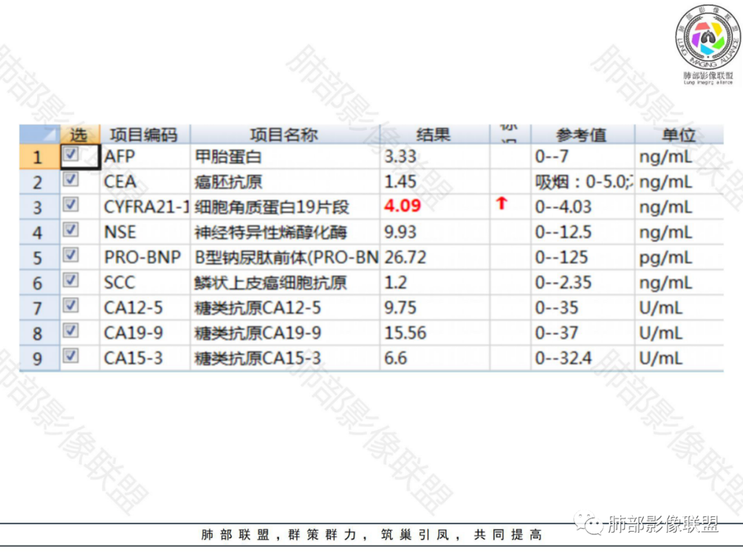 影像PPT - 【病例】左下肺典型类癌1例CT影像讨论-3 影像PPT - 【病例】左下肺典型类癌1例CT影像讨论-3