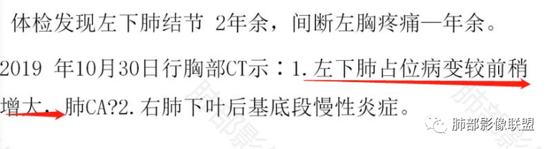 影像PPT - 【病例】左下肺典型类癌1例CT影像讨论-25 影像PPT - 【病例】左下肺典型类癌1例CT影像讨论-25