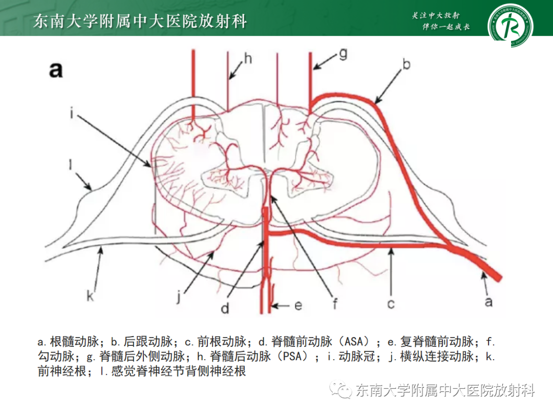 影像PPT - 【病例】平山病1例MR影像-9 影像PPT - 【病例】平山病1例MR影像-9