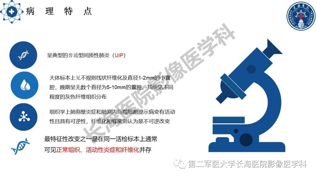 影像PPT - 【PPT】特发性肺纤维化的影像表现-4
