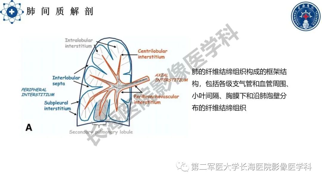 影像PPT - 【PPT】特发性肺纤维化的影像表现-5