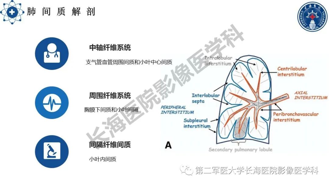 影像PPT - 【PPT】特发性肺纤维化的影像表现-6